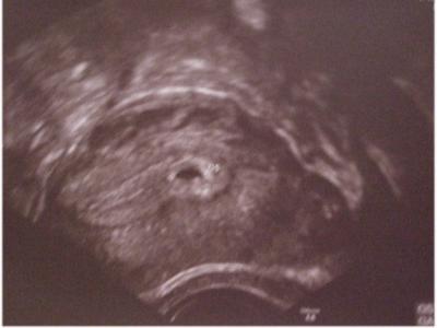 Bild zu Hab heute mein 1. Bildchen bekommen! - Forum für Dezember - Mamis