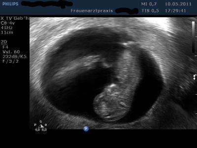 Bild zu Bin wieder dahaaa!! :o) - Forum für Dezember - Mamis