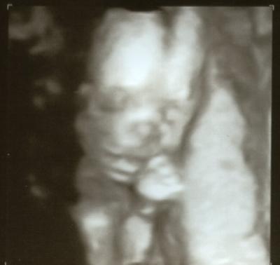 Bild zu Ich möchte euch mal was zeigen - vor allem für die Erst-Mamas vielleicht :) - Forum für Dezember - Mamis
