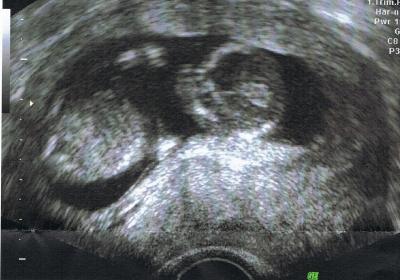 Bild zu neues bild :) - Forum für Dezember - Mamis