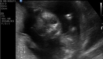 Bild zu Habe ich euch schon meine Zombiene gezeigt?? - Forum für Dezember - Mamis