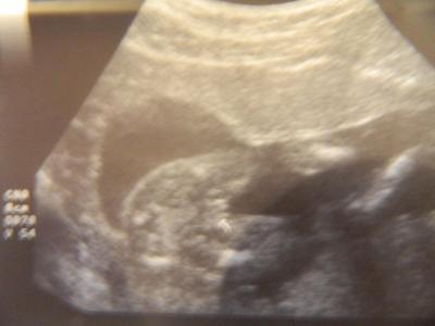 Bild zu Eindeutig ein Mädchen oder? - Forum für Dezember - Mamis