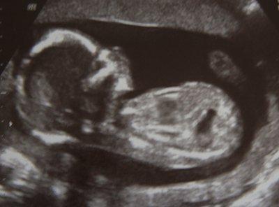 Bild zu Ich steuere auch was dazu... - Forum für Dezember - Mamis