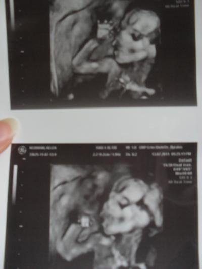 Bild zu Outing und erstes Anklopfen vom Baby + US-Bild - Forum für Dezember - Mamis