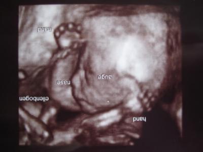 Bild zu Wir bekommen einen kleinen alten Mann... - Forum für Dezember - Mamis