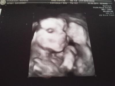 Bild zu Organscreening & Kontrolle :) - Forum für Dezember - Mamis