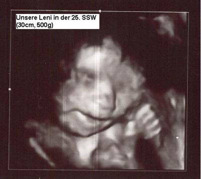 Bild zu Zurück vom 3D Ultraschall und endlich OUTING ;-) - Forum für Dezember - Mamis