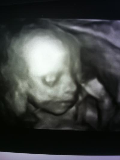 Bild zu 4d bilder .. - Forum für Dezember - Mamis