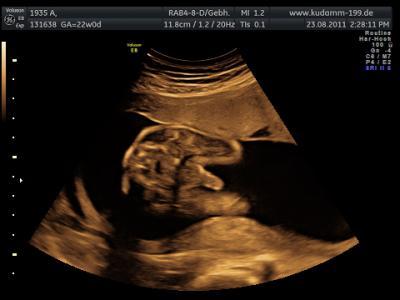 Bild zu Mein Baby hat ein Riesen... :-) - Forum für Dezember - Mamis