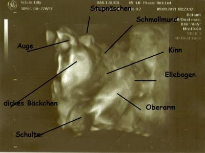 Bild zu US-Bild 27 SSW - Forum für Dezember - Mamis