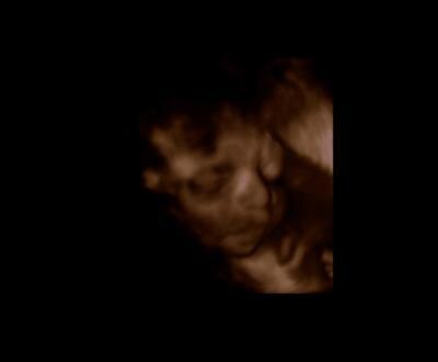 Bild zu 3D Bild - Forum für Dezember - Mamis