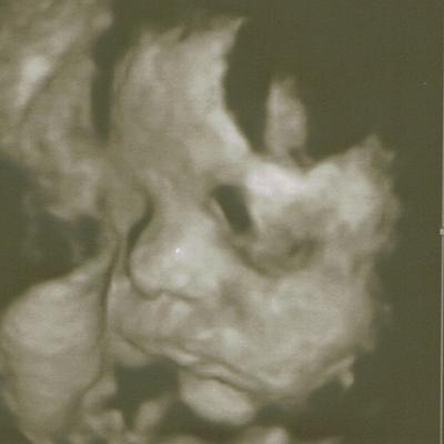 Bild zu VU-Bericht und Porträtfoto ;) - Forum für Dezember - Mamis