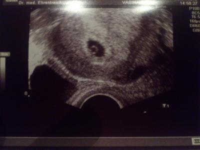 Bild zu Erstes Bild von unserem Wurmi - Forum für Dezember - Mamis
