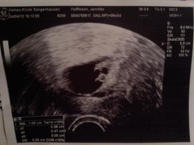 Bild zu Zurück vom KH :( - Forum für Dezember - Mamis