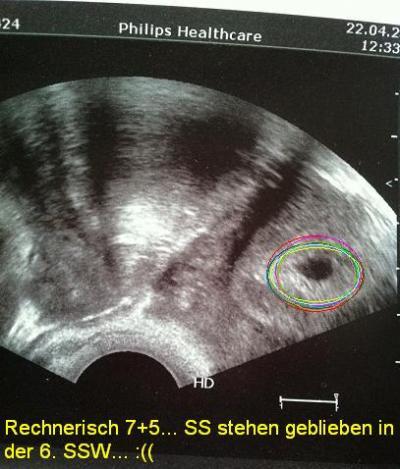 Bild zu Hoffe bei euch... - Forum für Dezember - Mamis