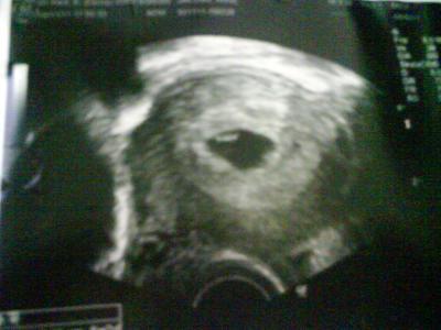 Bild zu HuHu schleiche mich mal zu euch =) - Forum für Dezember - Mamis