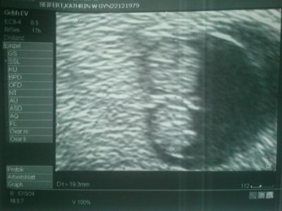 Bild zu Zurück vom FA und Bildchen - Forum für Dezember - Mamis