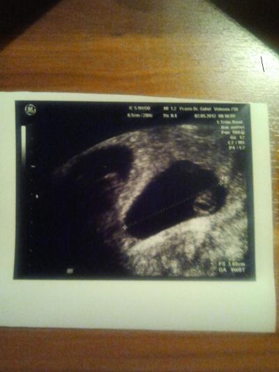 Bild zu Das erste Bild wo man von beiden ein bisschen sehen kann... - Forum für Dezember - Mamis