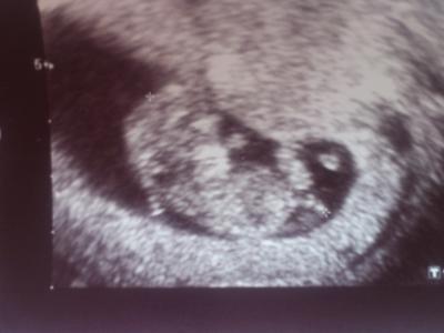 Bild zu zurück von der Frauenärztin... - Forum für Dezember - Mamis
