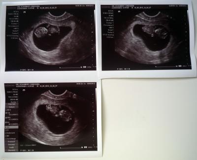 Bild zu und auch ich zurück vom FA ... mit kleinem SportlerIn im Bauch ^^ - Forum für Dezember - Mamis