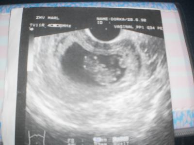 Bild zu FA-Termin + Bild :) - Forum für Dezember - Mamis