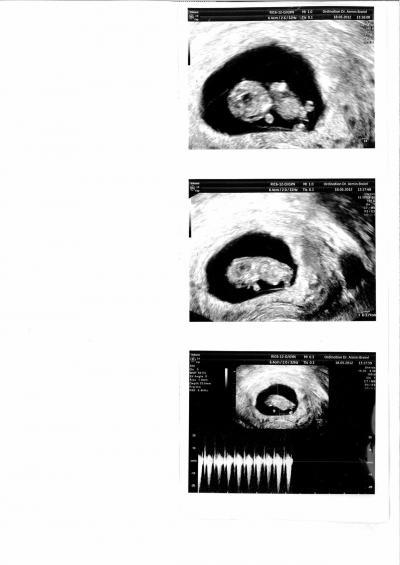 Bild zu Bildchen vom FA - Forum für Dezember - Mamis