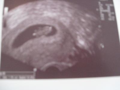 Bild zu Mutterpass & Sea-Band - Forum für Dezember - Mamis