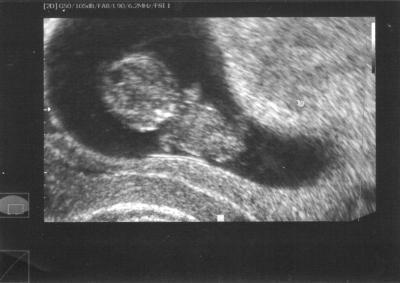 Bild zu US Bild von der letzten Vorsorge - Forum für Dezember - Mamis