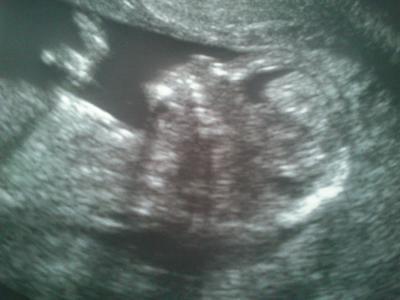 Bild zu Auch zurück vom FA mit Bild - Forum für Dezember - Mamis