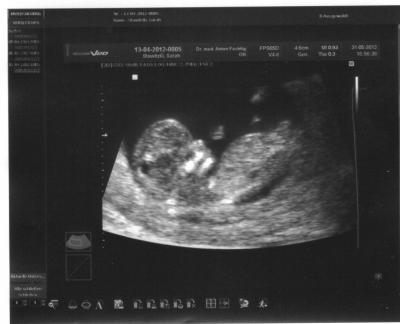 Bild zu Mein Baby-zurück vom FA - Forum für Dezember - Mamis