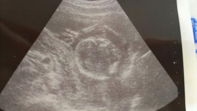 Bild zu Juhu, seit gestern 17. Woche - Forum für Dezember - Mamis
