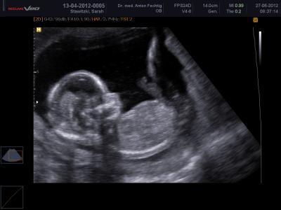 Bild zu Zurück vom FA mit Outing!!! - Forum für Dezember - Mamis