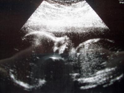 Bild zu endlich mal ein schönes bildchen... - Forum für Dezember - Mamis