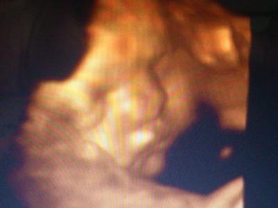 Bild zu Unser Prinz.... - Forum für Dezember - Mamis