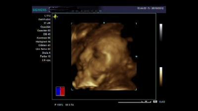 Bild zu FA und 3 D Ultraschall heute - Forum für Dezember - Mamis