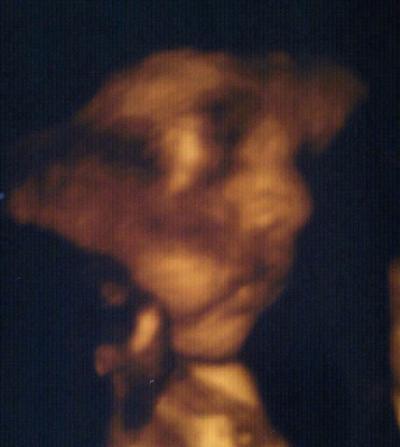 Bild zu mein 4d foto . gestern gemacht worden 31ssw. - Forum für Dezember - Mamis