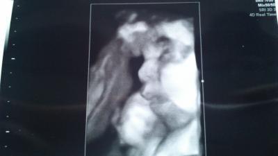 Bild zu zurück von FA + Bild :-) - Forum für Dezember - Mamis