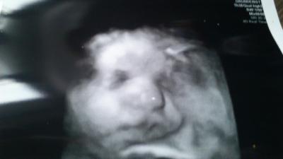 Bild zu zurück vom letzten FA-Besuch... - Forum für Dezember - Mamis