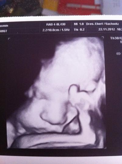 Bild zu 3d Bilder - Forum für Dezember - Mamis