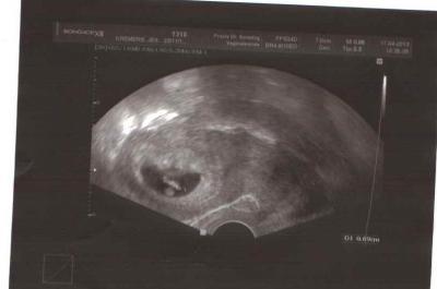 Bild zu Bild vom 17.4.13 - Forum für Dezember - Mamis