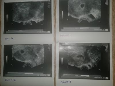 Bild zu Entwicklung innerhalb von 4 Wochen - Forum für Dezember - Mamis