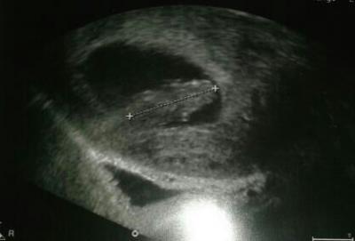 Bild zu bild von meinen 3 cm gummibaerchen ;) - Forum für Dezember - Mamis