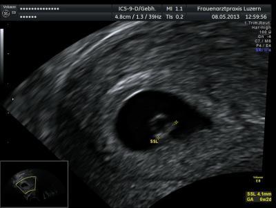 Bild zu Erst in 5 Wochen den nächsten Termin ist das normal? - Forum für Dezember - Mamis