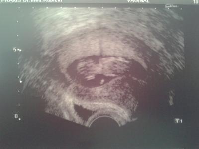 Bild zu ich bin sooo gluecklich ... !!! - Forum für Dezember - Mamis