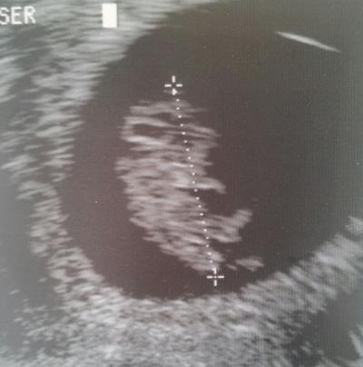 Bild zu mein Termin... - Forum für Dezember - Mamis