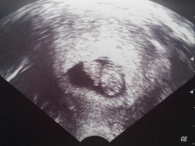 Bild zu Juhu .... unser Gummibärchen ... :-D - Forum für Dezember - Mamis