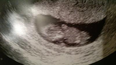 Bild zu unser Gummibär :-) - Forum für Dezember - Mamis
