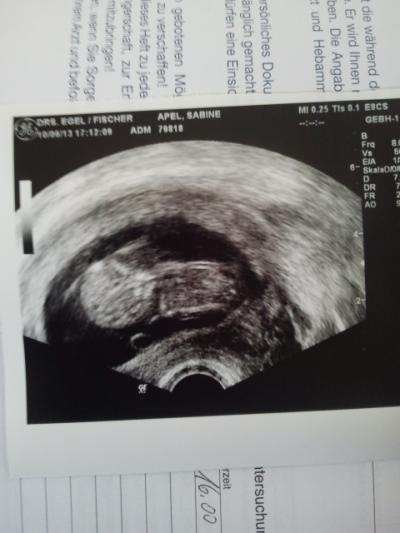 Bild zu Unser Baby< 3 - Forum für Dezember - Mamis