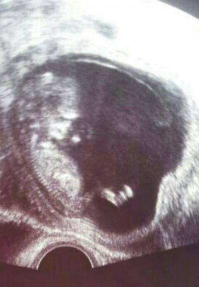 Bild zu Ultraschallbild :) - Forum für Dezember - Mamis