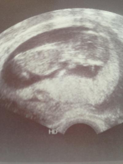 Bild zu Wie groß sind eure Würmchen ? - Forum für Dezember - Mamis